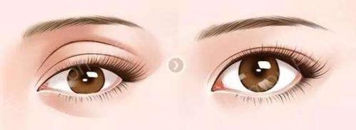 潍坊天宏医疗美容医院自体脂肪丰鼻基底真实案例解析：