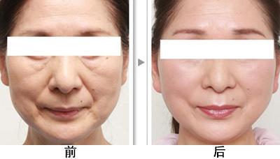 北京朝阳区知名医疗美容医院排名，这三家机构值得信赖