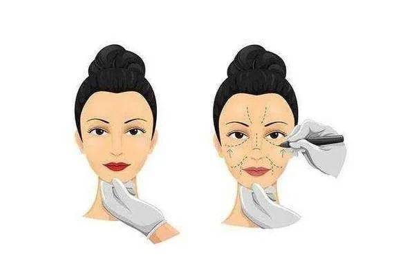 海南省第五人民医院抗衰除皱多少钱？专家团队介绍及价