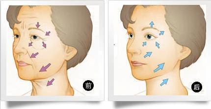 长沙水光除皱哪家医院好？排名前五实力盘点