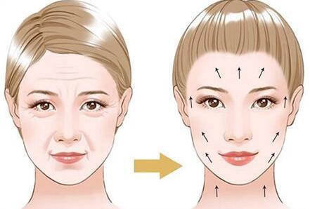 中山抗衰除皱哪家强？美南华李劼、爱汇星贺鑫等五位医