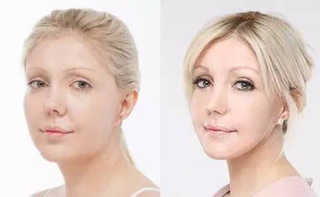 成都抗衰除皱哪家医院技术好？五大专业医美机构实力对