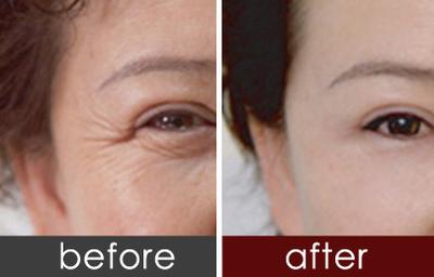 沈阳抗衰除皱哪家医院好？杏林、曙光、安娜宝士丽等专