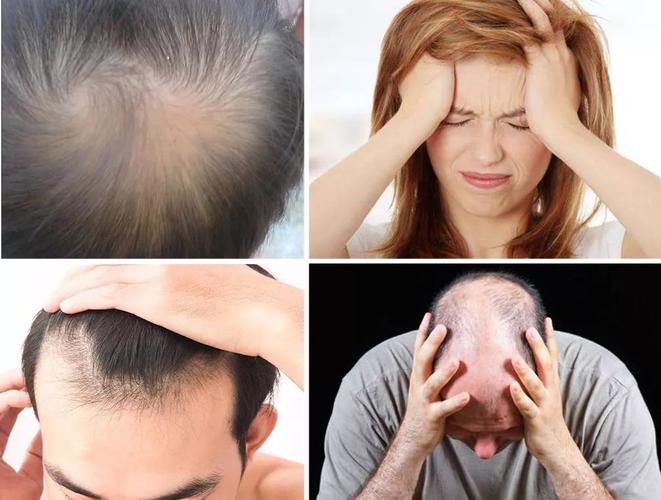 2025沈阳专业植发医院排名榜单｜机构与医生团队推