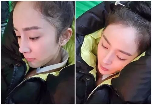 长沙发际线种植医院哪家好？公立私立优质机构实力盘点