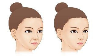 赣州水光针医生哪家强？吴彩霞、杨中华等皮肤大咖实力