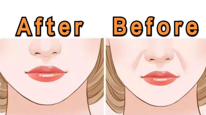 昆明自体脂肪丰鼻基底哪家医院好？5家优质机构深度解