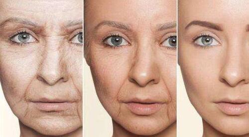 三亚吉阳轻颜医疗美容诊所怎么样？玻尿酸祛法令纹实力