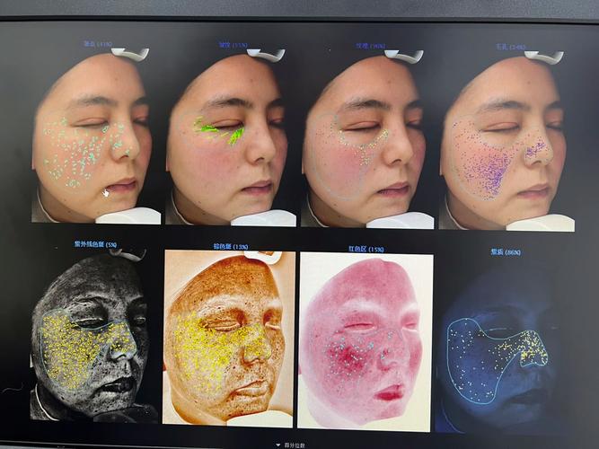 昆明光子嫩肤哪家医院好？2025年排名及价格参考