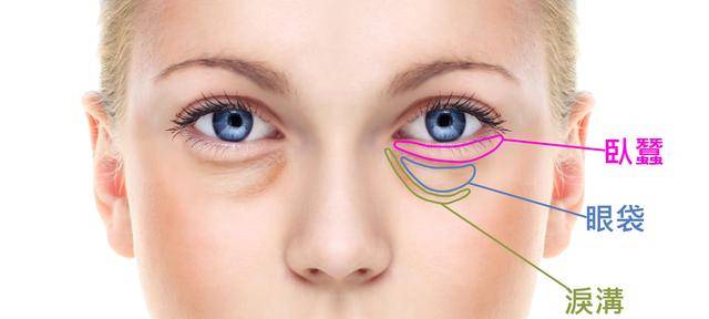 深圳做自体脂肪祛泪沟靠谱的医院有哪些？这份精选名单