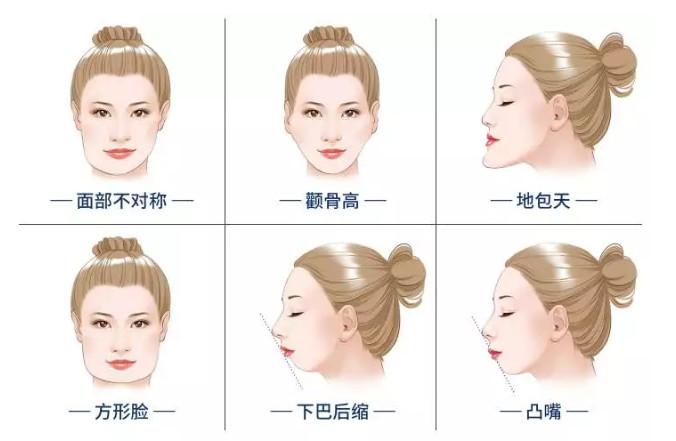 怀化磨骨哪家医院好？精选5家正规机构：鹤城天姿、溆