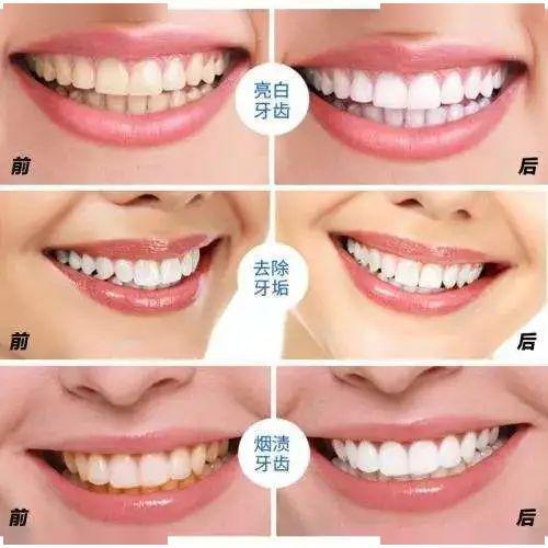 在十堰牙齿疼痛难忍？曝光当地口碑口腔医院，仁美口腔