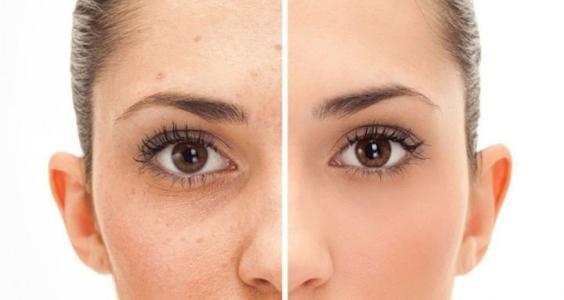 金华激光祛斑哪家医院效果好？精选五家正规医疗美容机