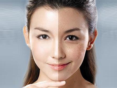 郑州2025祛斑医生排名榜公布！方琴、钟玉培实力上