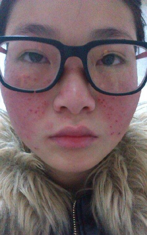 合肥祛斑哪家医院好？维多利亚、台美丽格、国仁技术专