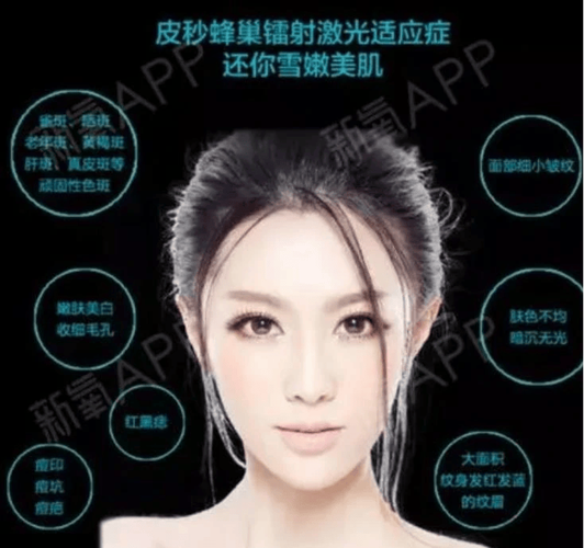 合肥激光祛斑哪家医院效果更好？排名前五中韩美、恒美