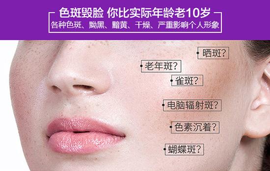 杭州激光祛斑整形医院哪家好？TOP5专业机构技术优