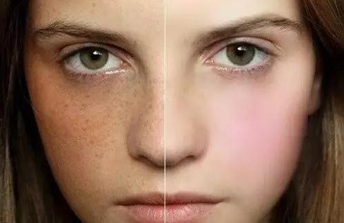 达州激光祛斑医院哪家靠谱？精选5家专业医疗美容机构