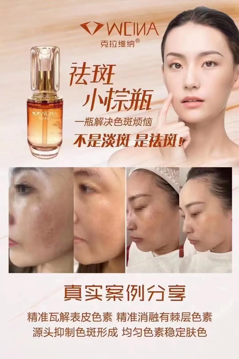 郴州整形激光祛斑哪家医院技术好？精选5家实力口碑并