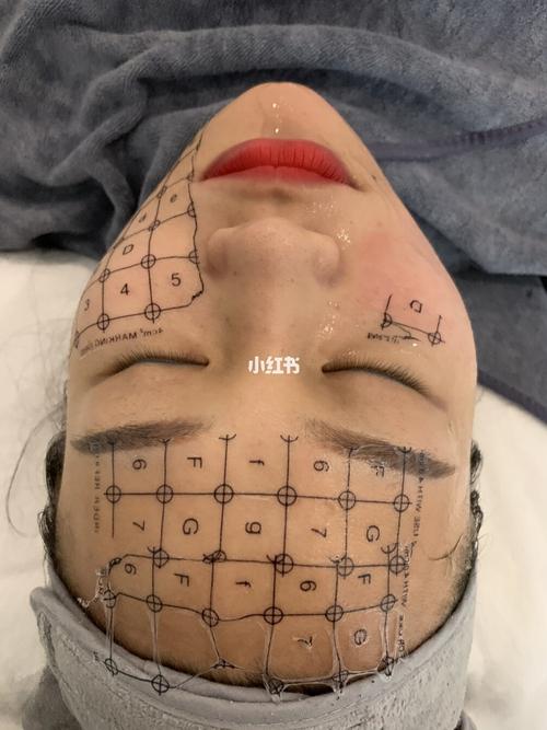 大连眼部热玛吉医院哪家好？专业医生团队与价格信息详