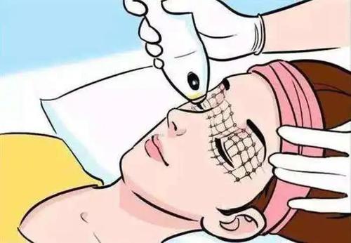 徐州眼部热玛吉医生精选推荐！专业医师打造自然年轻眼