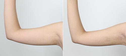 郑州美艺医疗美容怎么样？专业整形医院项目价格及医生