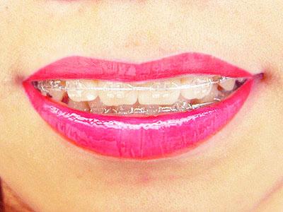 南京口腔整形医院哪家好？这五家医院技术过硬口碑佳