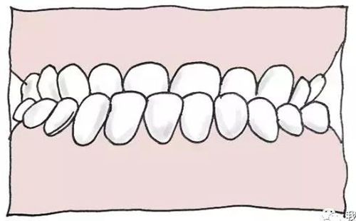 上海嘉会医疗牙齿矫正多少钱？医生团队介绍&