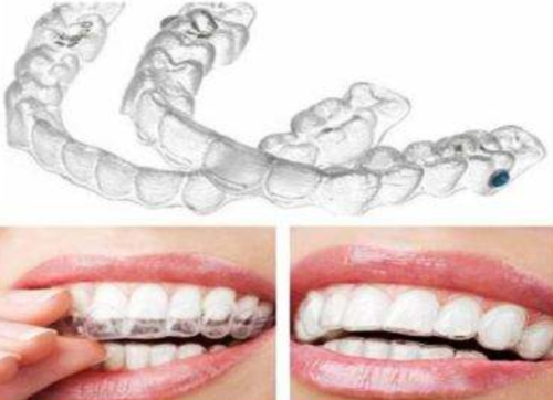 安徽做牙齿矫正好的医院排行？安医二附院，合肥二院等