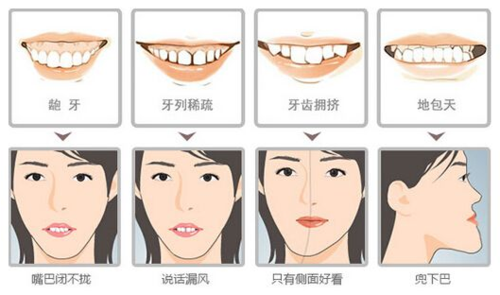 宁波哪些医院做牙齿种植好？专业医生团队与设备盘点，