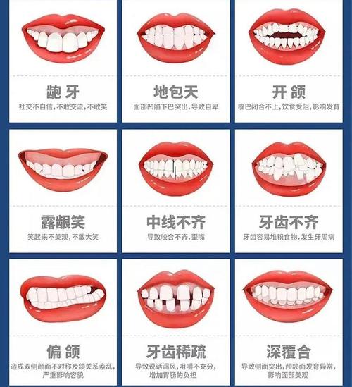 遂宁嘉慧口腔专家解析：牙齿矫正后咬合不适正常吗？初
