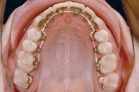 上海专业牙齿矫正医院排名榜单：精选8家优质机构信息