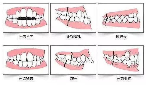 苏州金阊医院牙齿矫正怎么样？2025价格表及医生团