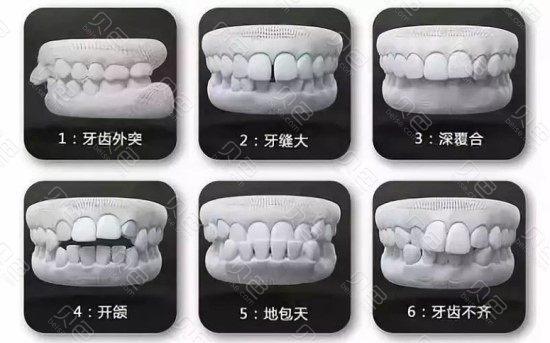 广州牙齿矫正医生排名，陈松龄、孔祥波等专家值得收藏