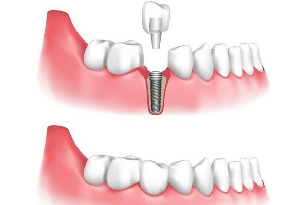 实地探访盘点！邵阳地区专业牙齿矫正口腔医院有哪些？
