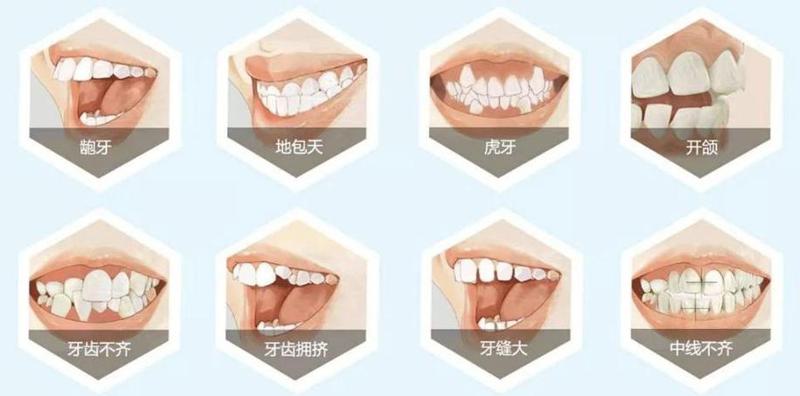 福州牙齿矫正哪家医院好？2025年口腔医院排名与专