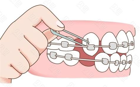 自贡禾悦口腔评价到底怎么样？五位牙友的真实矫正经历