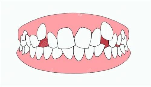 长沙牙齿矫正好的医院有哪些？这5家实力机构值得了解