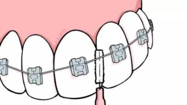 上海哪些医院牙齿矫正比较好？沃德、首尔丽格、沐良诚