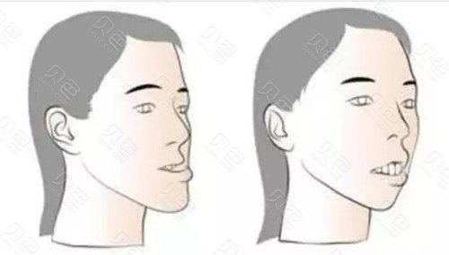 宁波牙齿矫正哪家医院好？协禾种植强、宁海牙科技术精