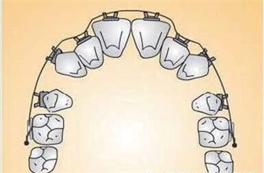 上海口腔整形医院排名榜专业测评：新华医院、嘉会国际