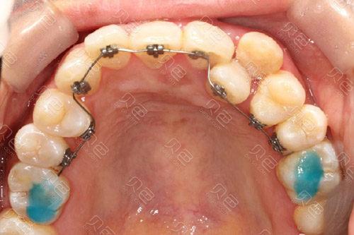 广州牙齿矫正哪家医院技术好？盘点6家实力强劲的口腔