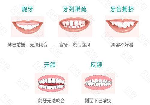 沈阳牙齿矫正哪家医院好？口腔机构实力盘点！