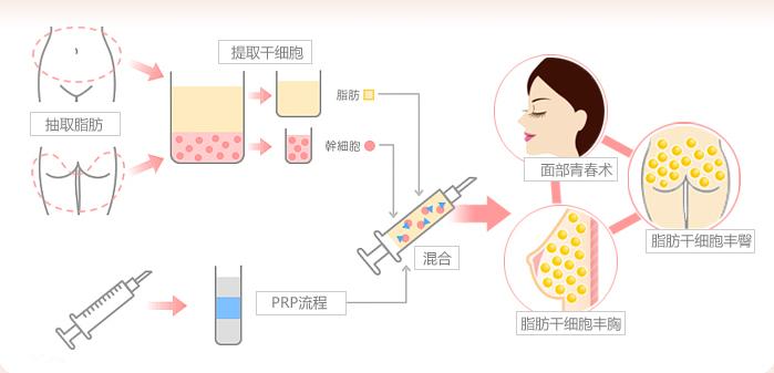 深圳医疗美容医院排名前十，专业医美机构实力盘点