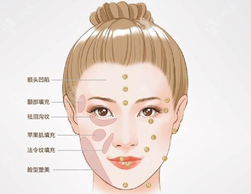 郑州自体脂肪填充哪家医院好？排名前五强专业测评_价