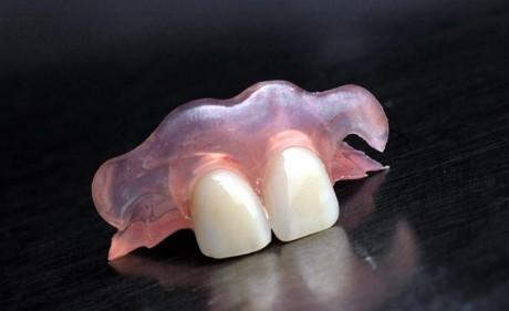 沈阳种植牙排名前五医院，中国医科大学附属盛京医院实