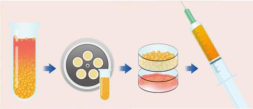 辽宁杏林整形外科医院崔昌墉医生自体脂肪填充技术怎么