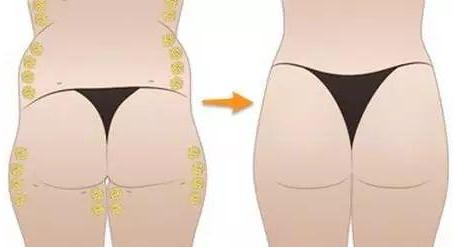 南昌自体脂肪丰卧蚕哪家医院好？5家正规机构医生技术