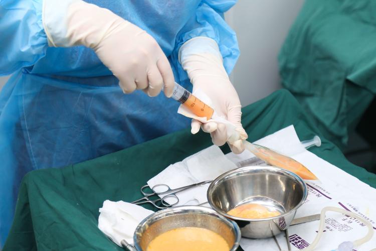 大连自体脂肪填充医院哪家好？五家优质机构实力对比