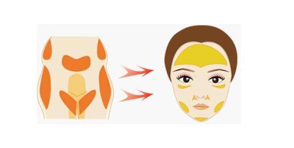 荆州哪些医院做自体脂肪祛泪沟好？四家专业机构对比分